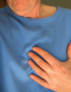 Heart transplantation Heart transplantation