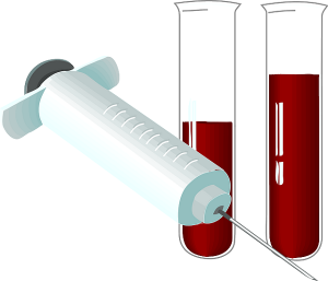 Q10 blood testing Blood work in the lab
