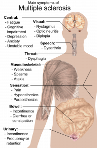 Symptoms of multiple sclerosis